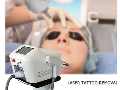 ND YAG laser tattoo removal machine
